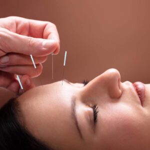 Postgrado Acupuntura Aplicada al Dolor