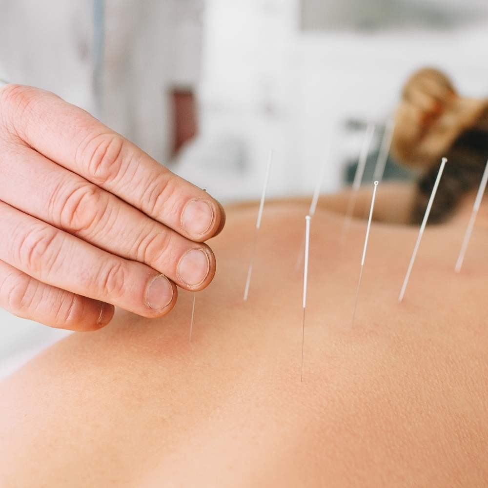 Acupuncture scientifique