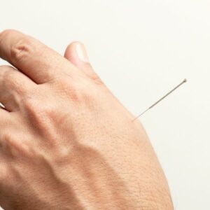 Acupuncture pour les os