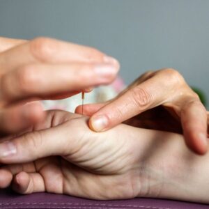 Points Acupuncture