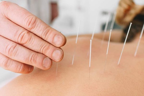 Acupuncture scientifique